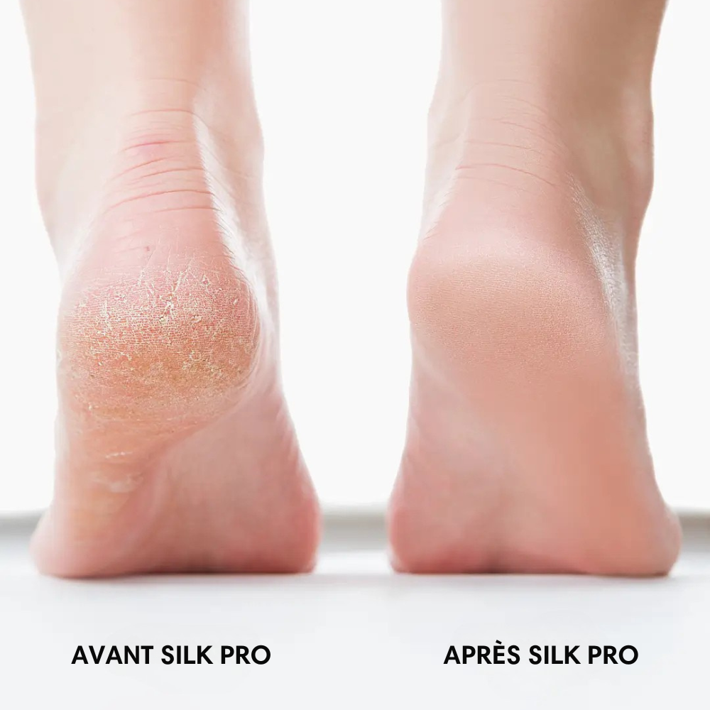 Silky Bliss Pro – Des pieds doux sans rendez-vous